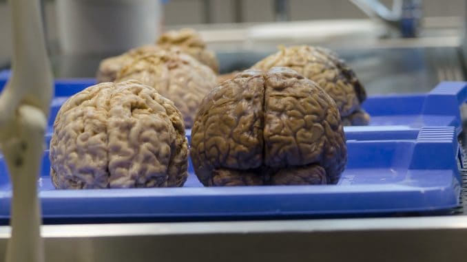 the-brain-470742_960_720
